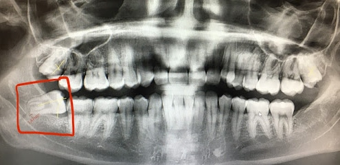 fotografía  Centro Dental Integral Dentista en San Roque